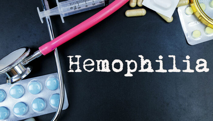 Hemophilia – Common Symptoms and Treatments