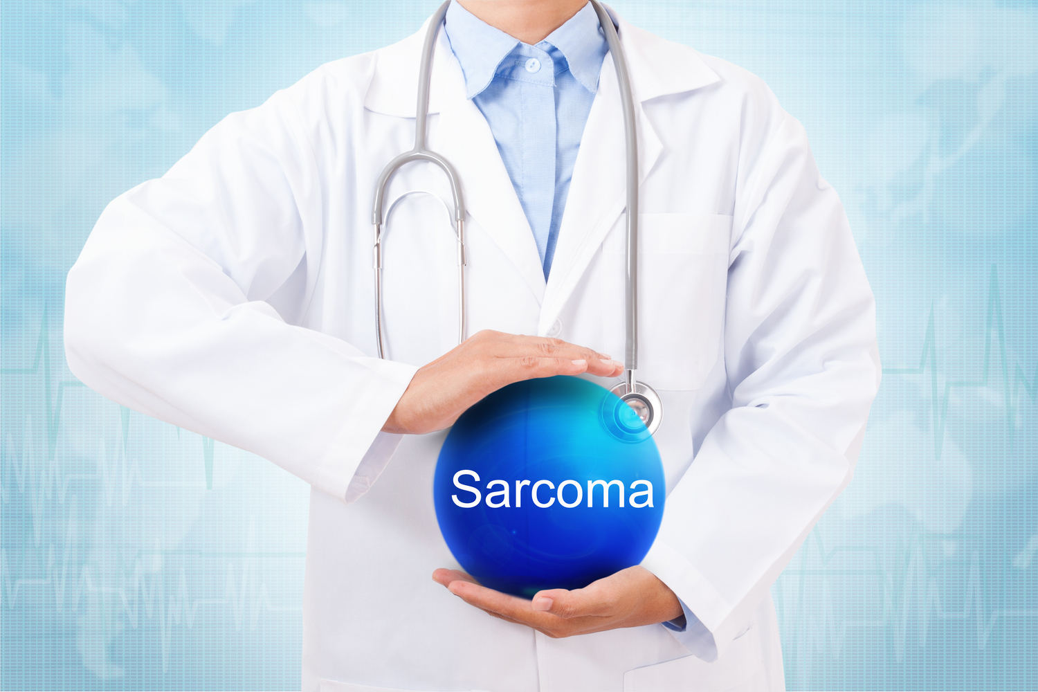 5 Early Warning Signs of Sarcoma