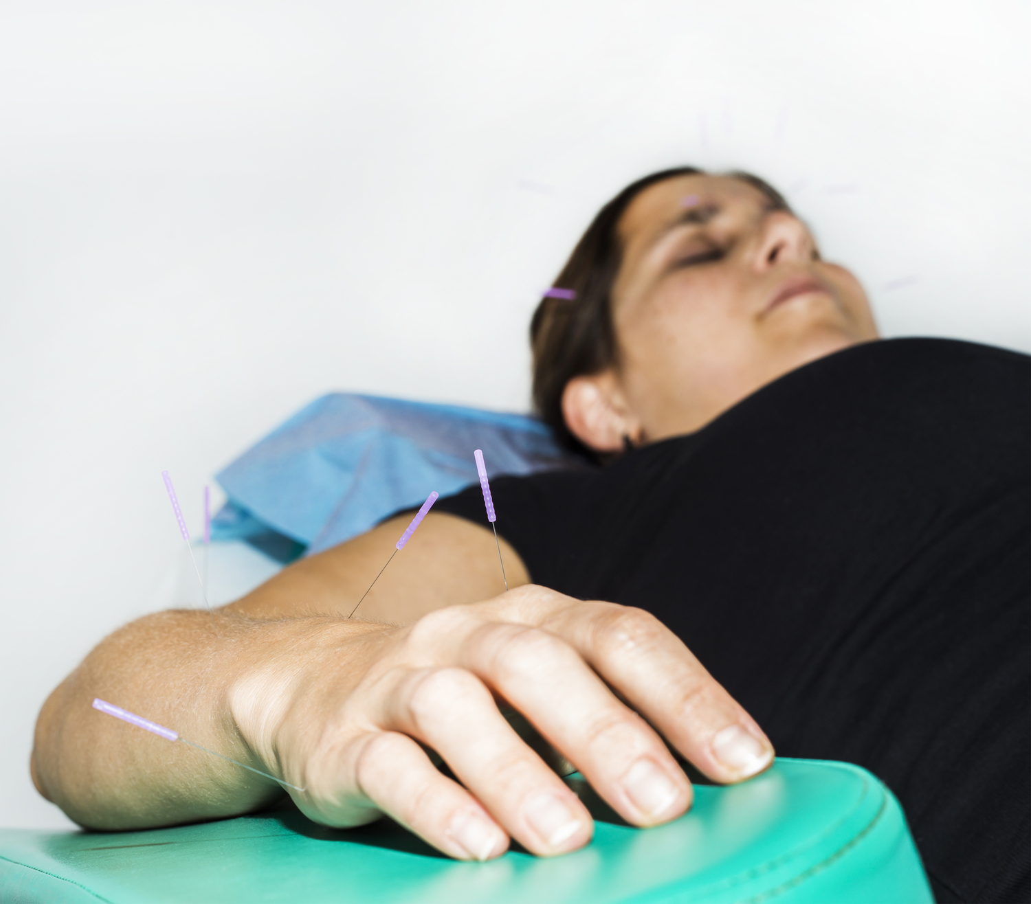 5 Top Remedies for Neuropathy